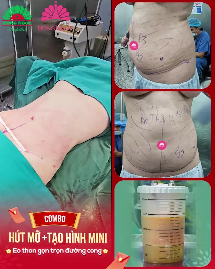 Cùng nói lời tạm biệt mỡ thừa để tự tin đón tết ngay thôi nào cả nhà ơi!!