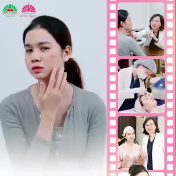 DA SẠCH MỤN CĂNG MƯỚT TỰ TIN ĐÓN TẾT