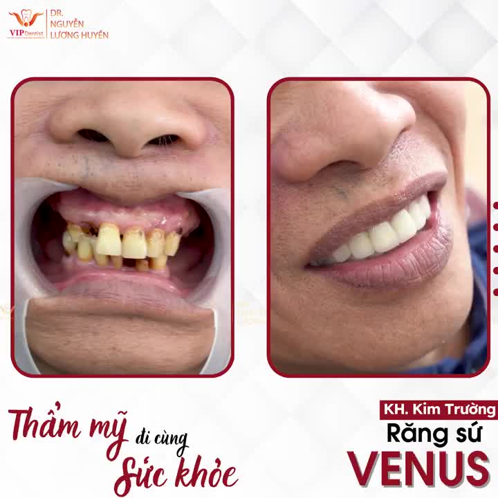NHÌN LẠI QUÁ TRÌNH THAY ĐỔI NỤ CƯỜI THẦN KỲ CỦA NAM KHÁCH HÀNG TRUNG TUỔI