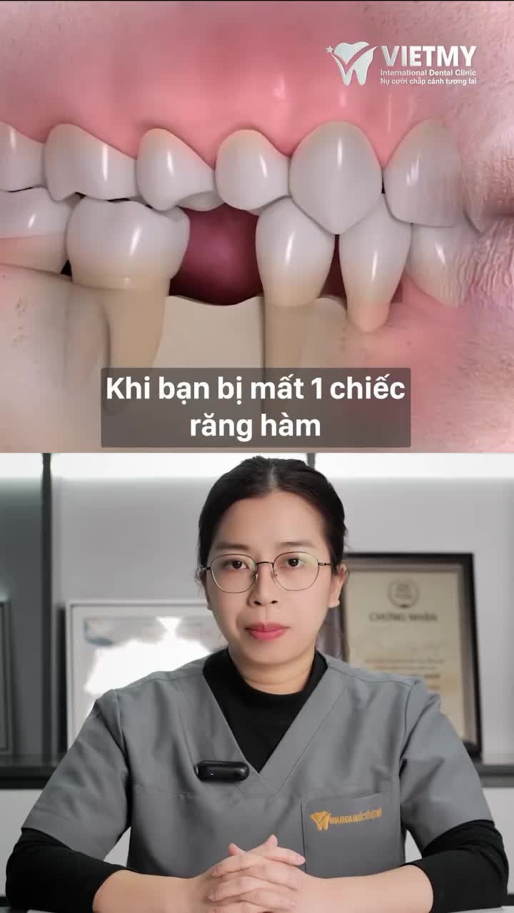 CHỦ ĐỀ "XƯA" NHƯNG CHƯA BAO GIỜ "CŨ": MẤT RĂNG LÂU NGÀY KHÔNG CAN THIỆP CÓ SAO KHÔNG? NẾU MUỐN THÌ LÀM SAO ĐỂ KHẮC PHỤC?!