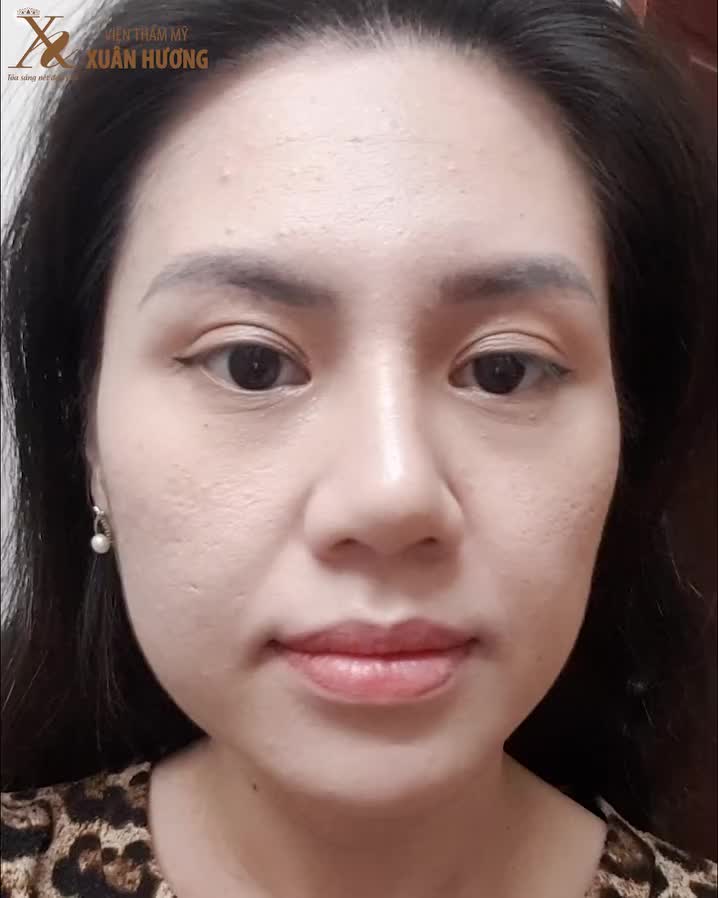 Làn da ở mỗi độ tuổi cần phương pháp chăm sóc khác nhau. Và trẻ hóa da PRP chính là giải pháp cho các tình trạng: