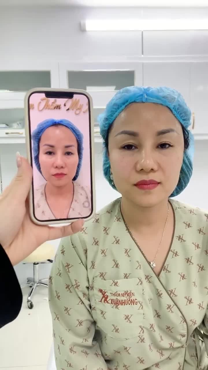 Kết quả độn thái dương