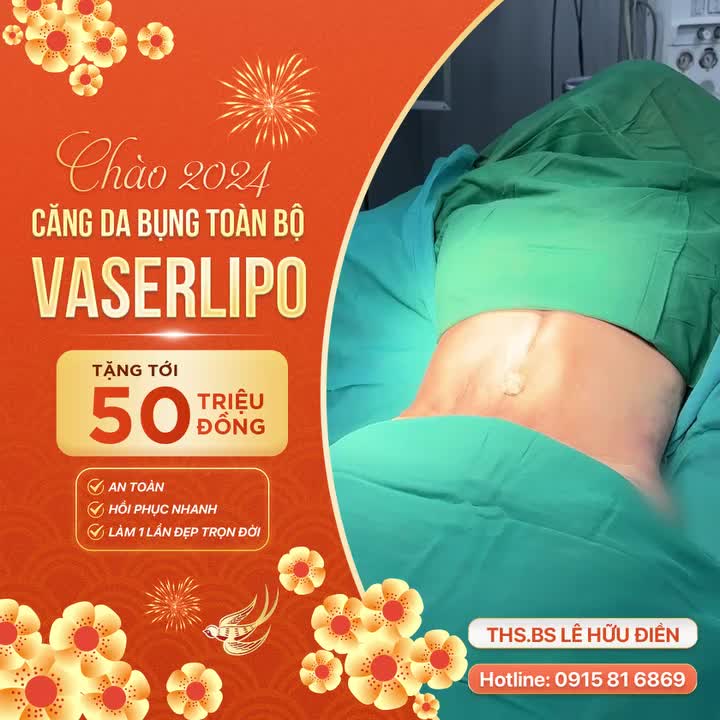 Bụng nhỏ, eo thon đón Tết Ưu đãi kịch sàn tặng tới 50TR