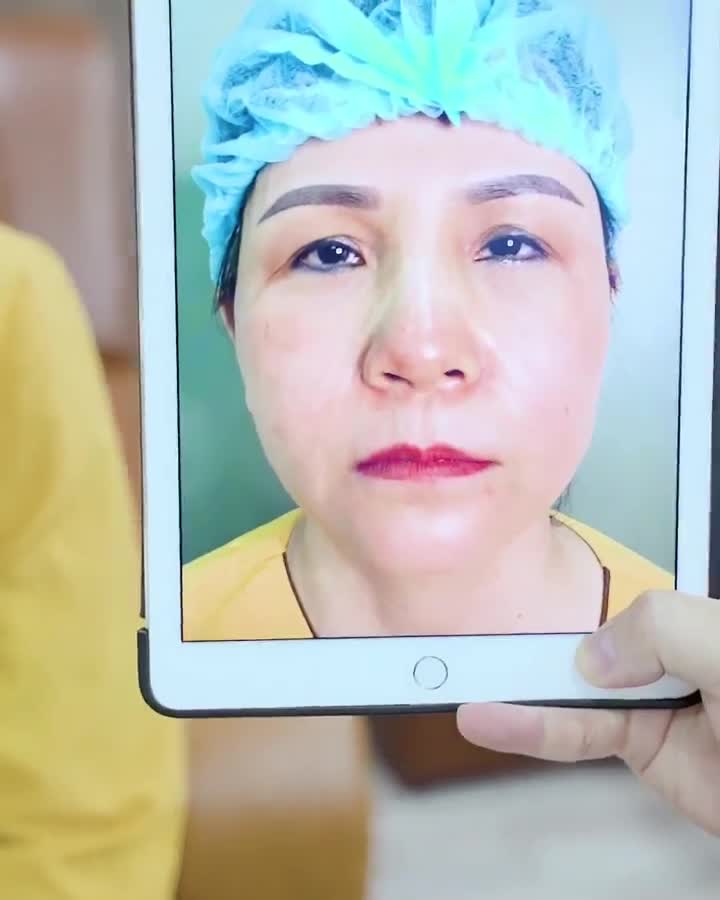 Căng da mặt trẻ ra 5-10 tuổi bạn có tin Theo dõi ngay