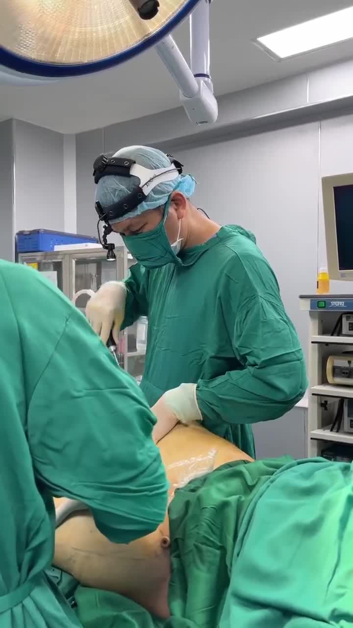 BÁC SĨ ĐIỀN HÚT MỠ ĐÙI BẰNG CÔNG NGHỆ VASER LIPO.