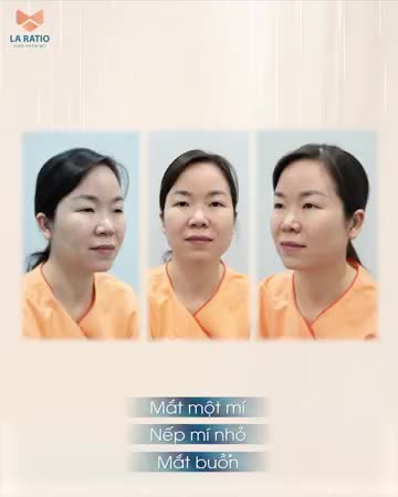 TẠM BIỆT ĐÔI MẮT DA TRÙNG, NẾP MÍ KHÔNG RÕ