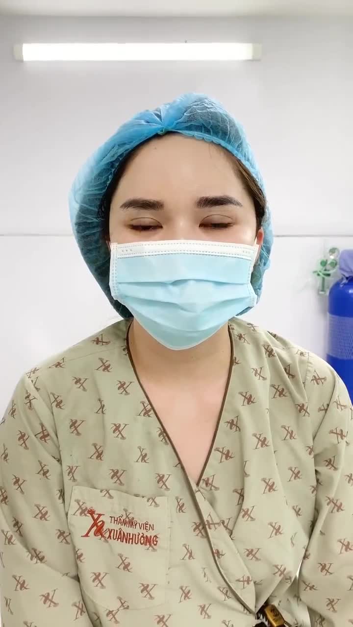 Hết gò má cao cùng độn thái dương