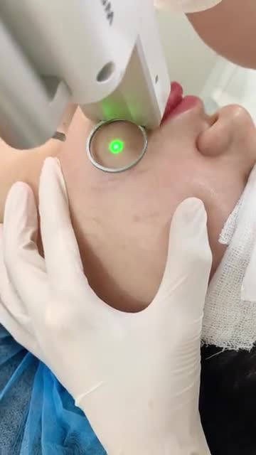 Tri giãn mao mạch da sáng mịn cùng nàng đón 8/3 rạng ngời