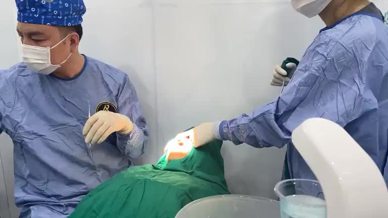 Case cấy ghép Implant tức thì nang chân răng không còn vách xương