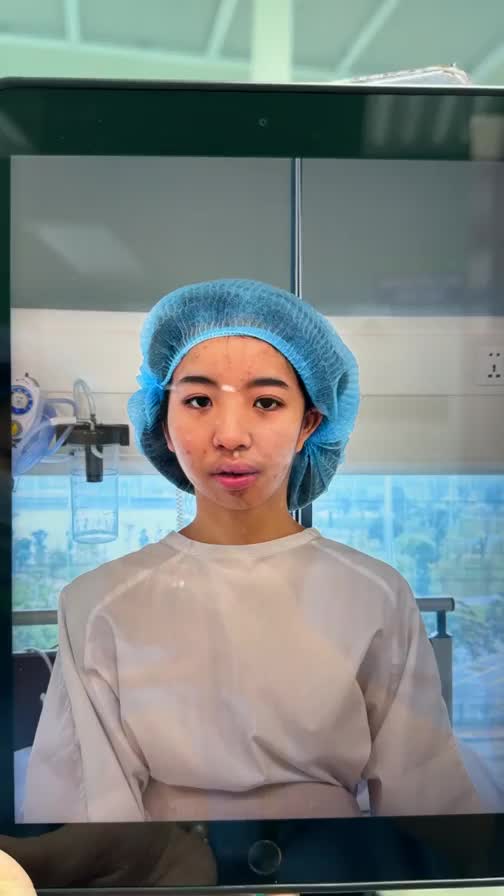 Pt chỉnh 2 hàm, trượt cằm cho bệnh nhân 16t