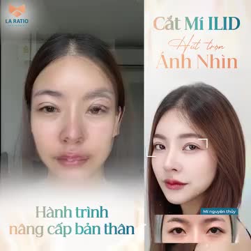THAY ĐỔI BẢN THÂN NHỜ NÂNG CẤP "CỬA SỔ TÂM HỒN"