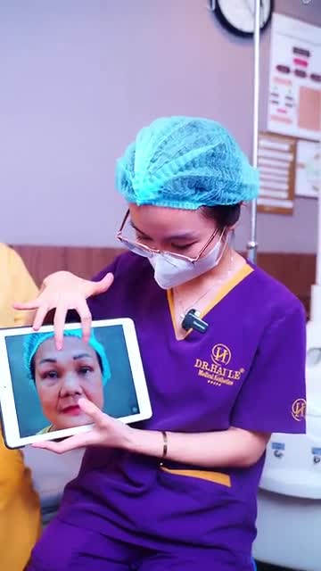 Nâng cung mày Dr.Hải Lê - Tầm nhìn thoáng đãng, đôi mắt nhẹ nhàng!