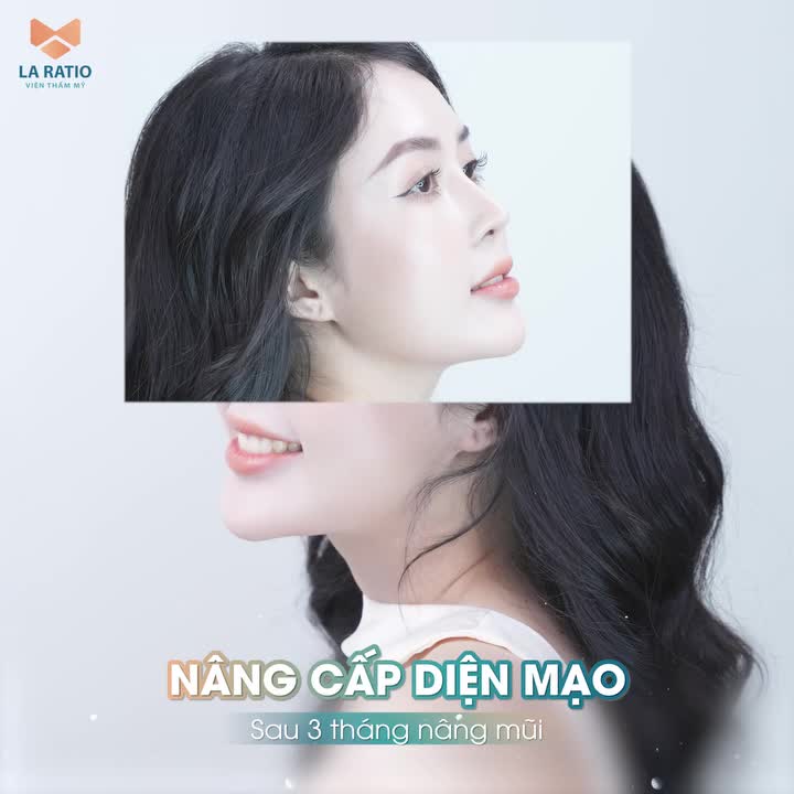 ĐÂY LÀ DÁNG MŨI 3 THÁNG TUỔI VẠN NGƯỜI MÊ