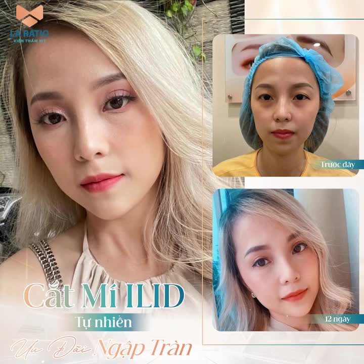 HÀNH TRÌNH CẮT MÍ ILID CỦA HOT GIRL CHICAGO