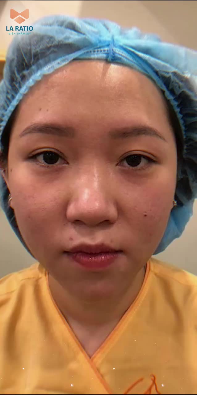 NÂNG MŨI THÊM XINH TỰ TIN MAKEUP KHÔNG CẦN TẠO KHỐI