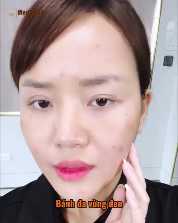 Dr.Hải Lê rất vui vì khách hàng đã tin tưởng và lựa chọn Tổ hợp Medi-R.BA tại Dr.Hải Lê - xu hướng làm đẹp mới nhất 2024