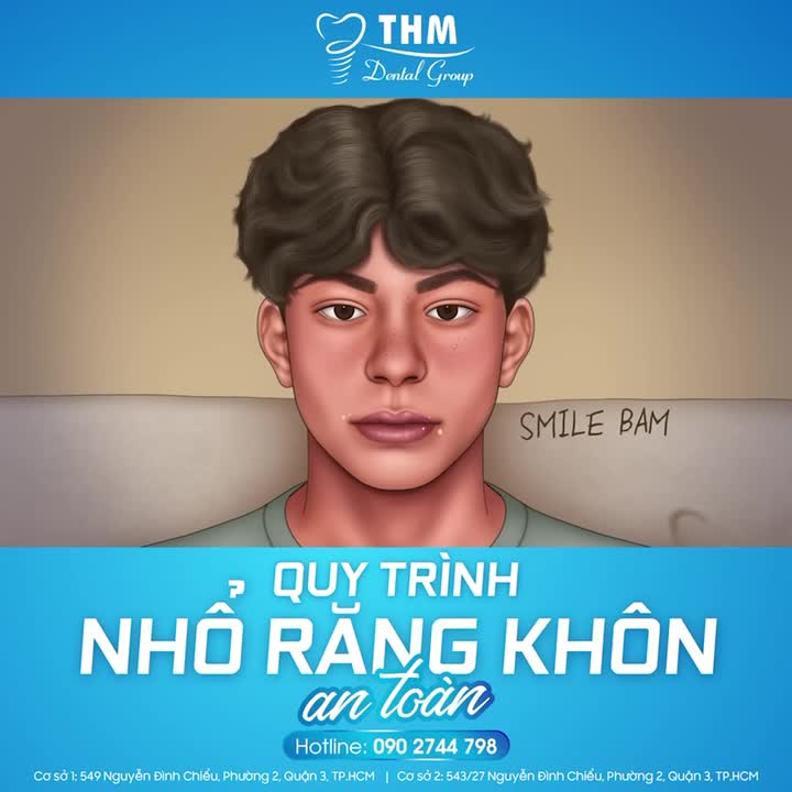 QUY TRÌNH NHỔ RĂNG KHÔN AN TOÀN!