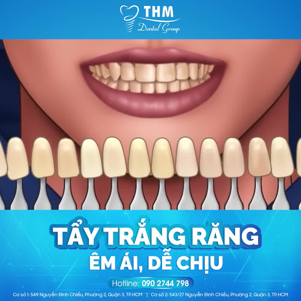 TẨY TRẮNG RĂNG ÊM ÁI, DỄ CHỊU