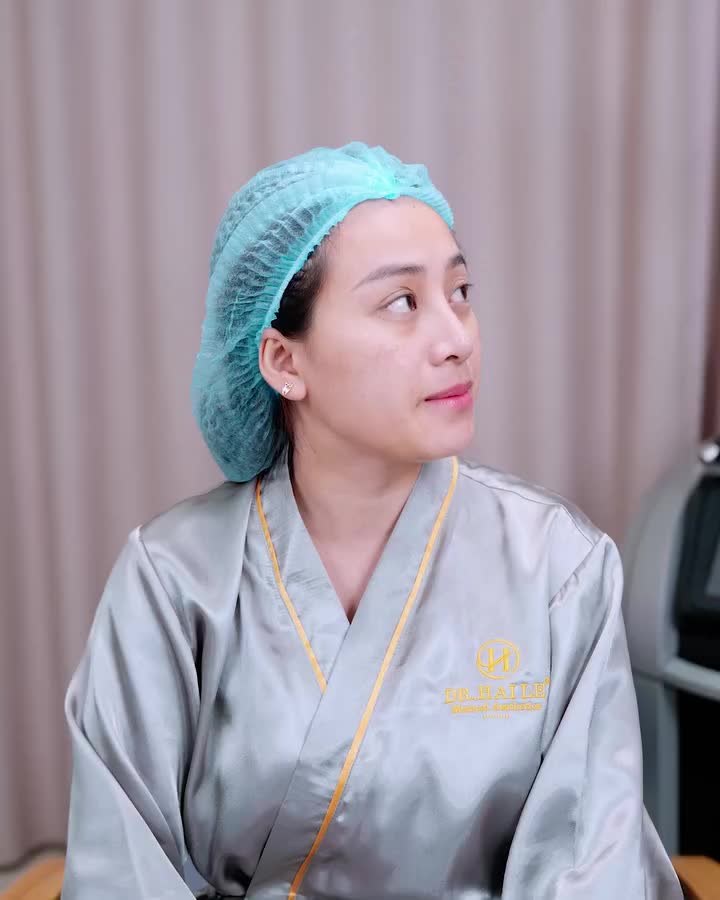 Chia sẻ của khách hàng Thùy Dương sau 3 buổi thực hiện Chuyển hóa nám Medi-R.BA tại Dr.Hải Lê.