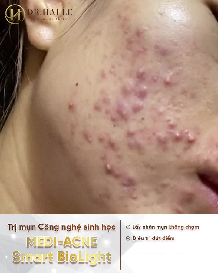 Quà tặng đặc biệt cho tất cả khách hàng đến với Dr.HaiLe trong tháng 5