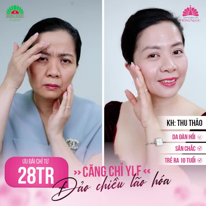 ĐẢO CHIỀU LÃO HÓA LẤY LẠI NHAN SẮC THANH XUÂN NHỜ CĂNG CHỈ YLF