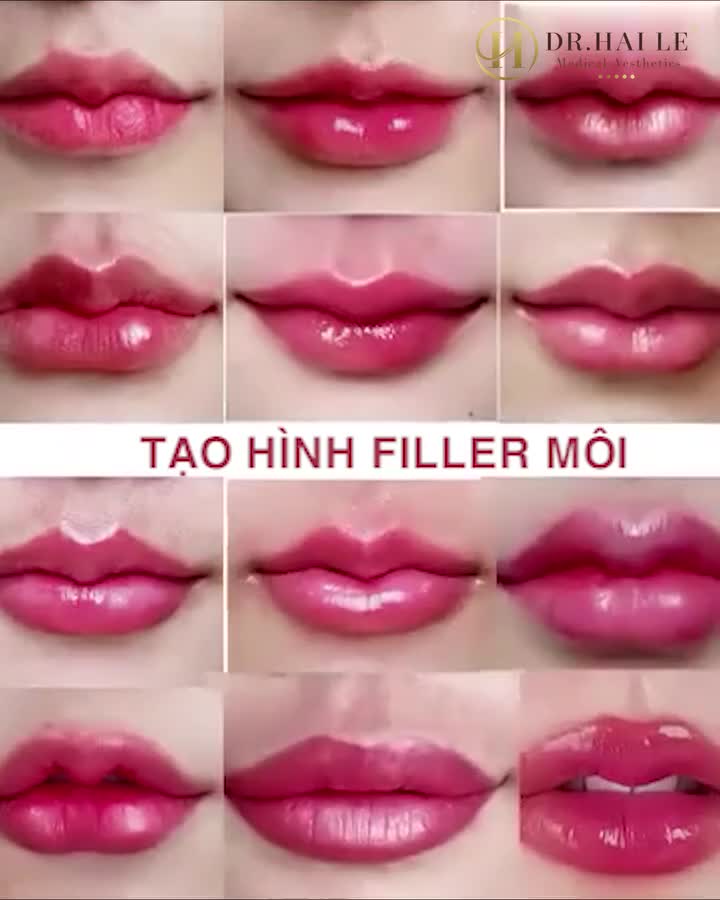 Chỉ 30 phút môi căng mọng nhìn là yêu