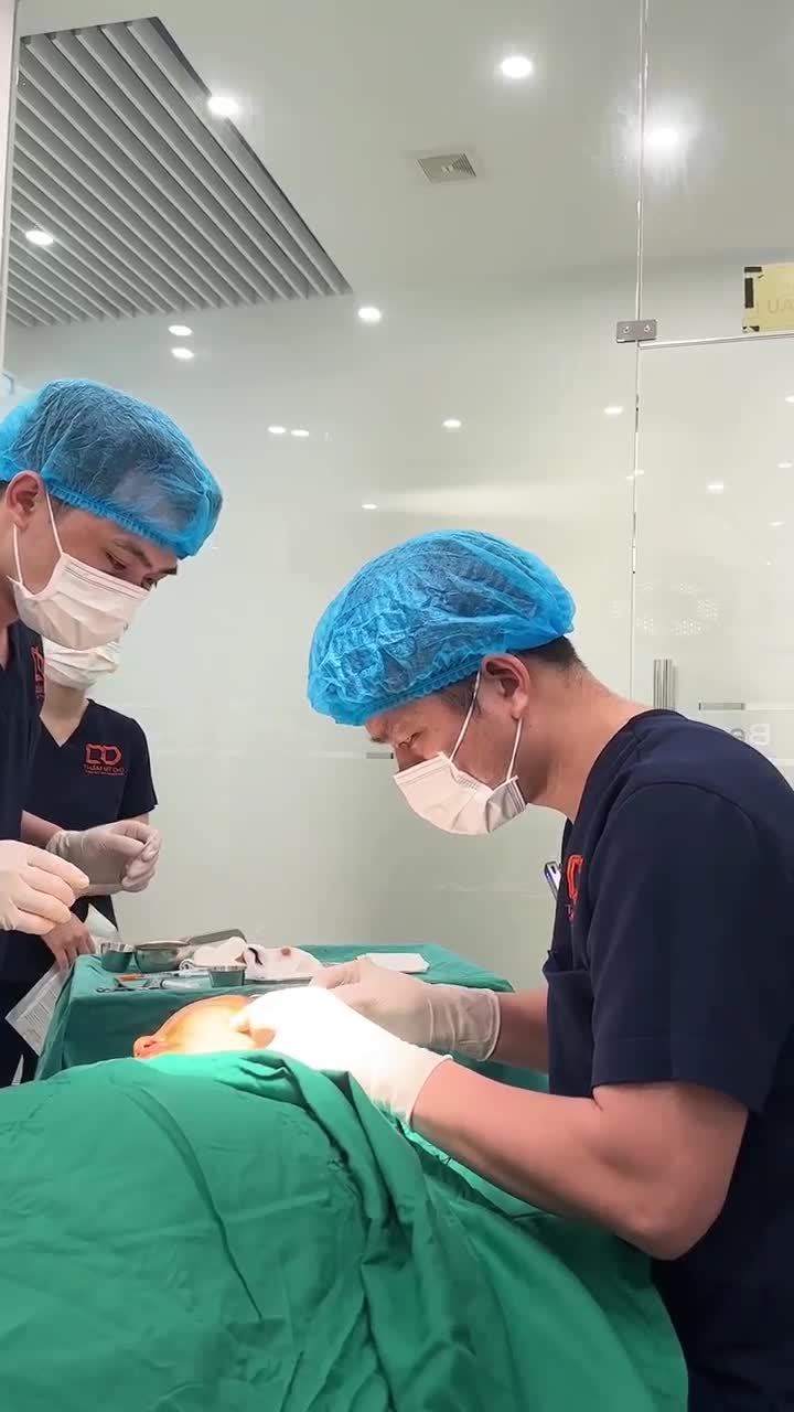 CĂNG CHỈ TOÀN MẶT CHO CHỊ KHÁCH HÀNG