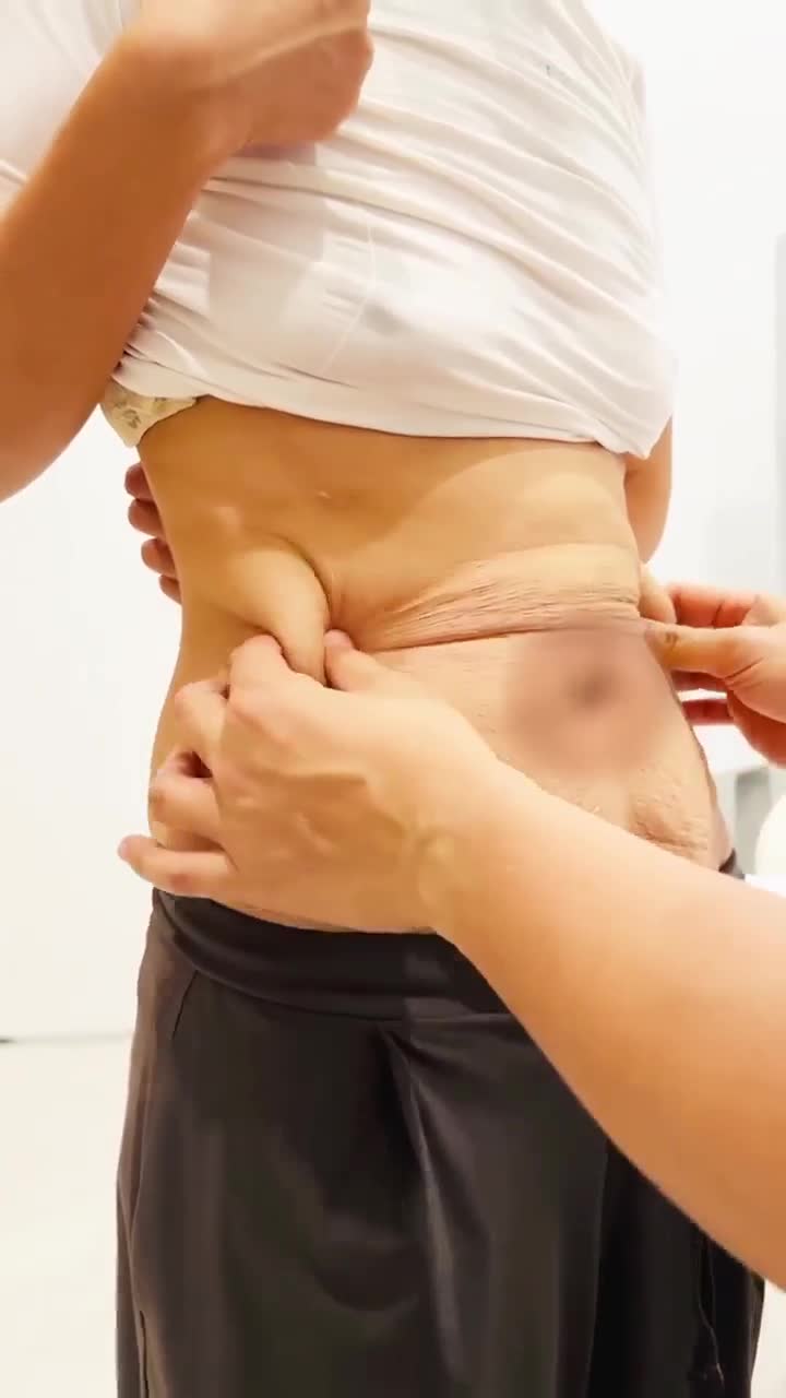 BÁC SĨ LÊ HỮU ĐIỀN TƯ VẤN KHÁCH PHẪU THUẬT TẠO HÌNH V2
