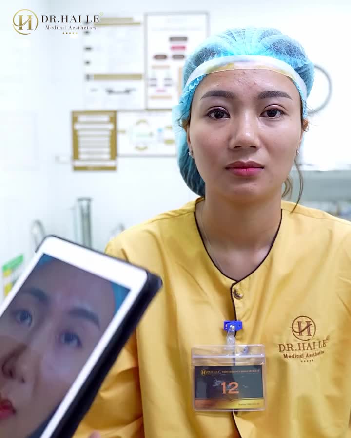 SỬA MÍ AN TOÀN CÙNG CHUYÊN GIA TẠI DR.HẢI LÊ