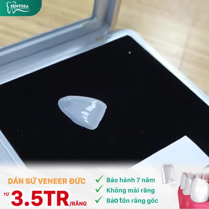 DÁN SỨ VENEER GIÁ TỐT NHẤT NĂM - RĂNG ĐẸP TRỌN ĐỜI CHỈ SAU 2 LẦN HẸN
