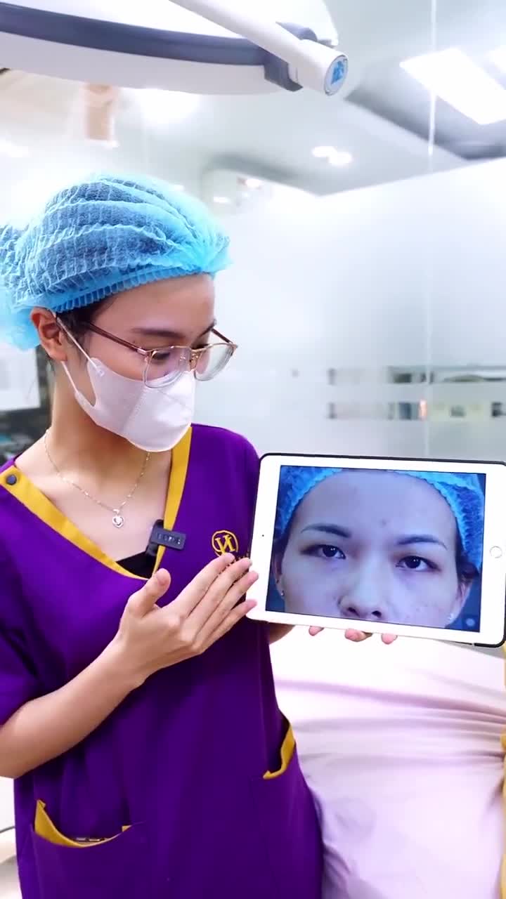 Cắt mí Dr.Hải Lê - Làm là đẹp!