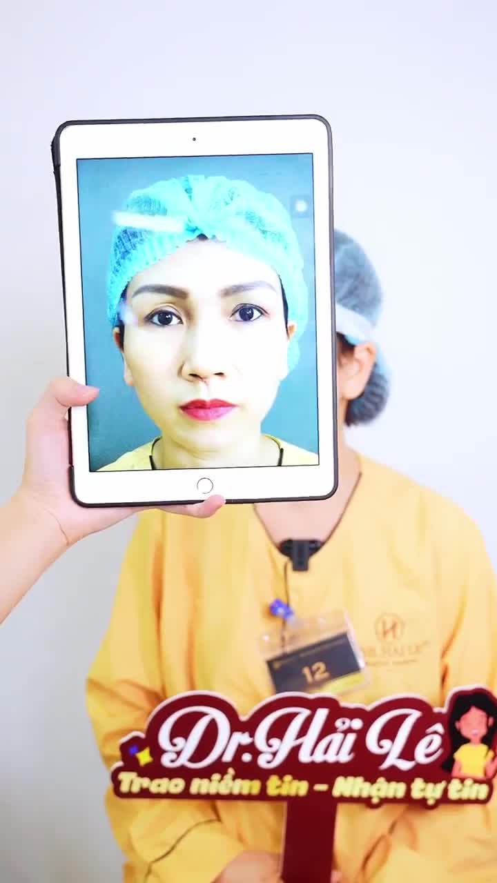 Combo Sửa mí + Nâng cung mày tại Dr.Hải Lê - Thăng hạng nhan sắc toàn diện!