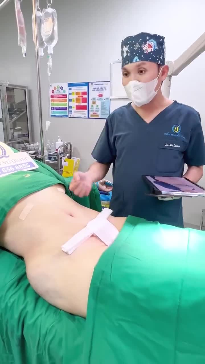 Kết quả hút mỡ và tạo hình thành bụng cho khách hàng đặc biệt của Bác Sĩ Vũ Quang