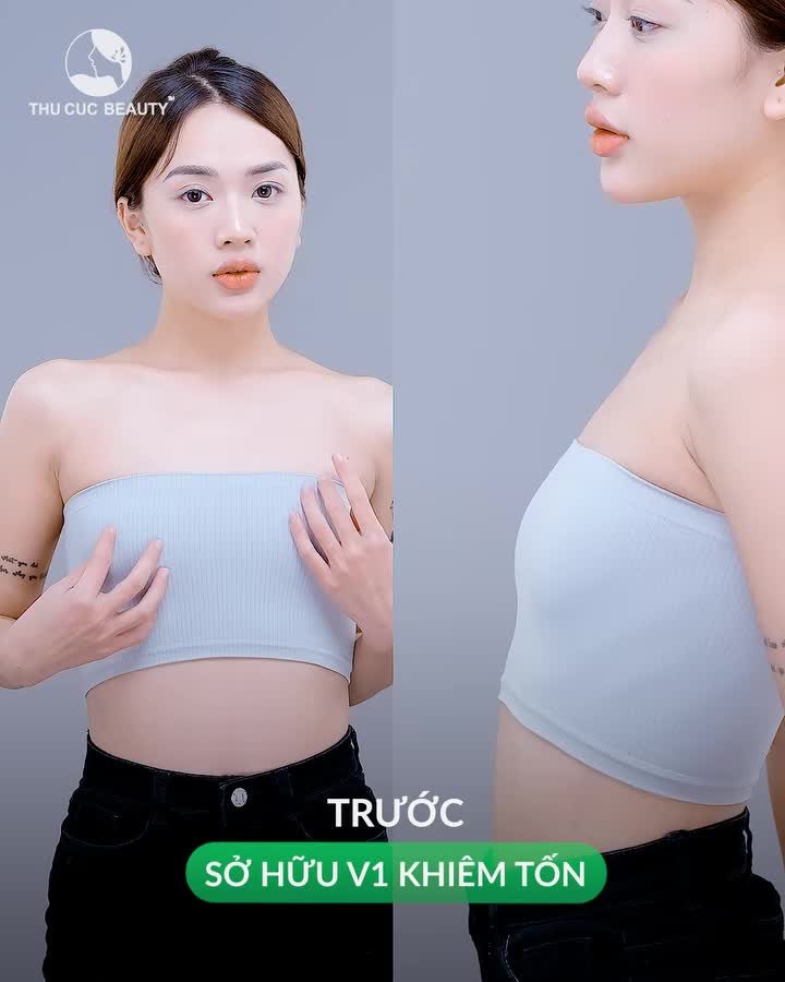 Biến hóa từ teo lép trở nên căng tròn cùng Ngực TC