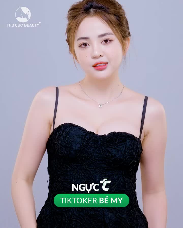 Ngực TC - Tạm biệt nỗi lo V1 teo lép  Bỏ ra 60P nâng ngực để nhận ngay V1:  Căng tròn, quyến rũ. Khe Y-line siêu cuốn Tự tin cân mọi trang phục  Gửi ảnh nhận tư vấn từ bác sĩ