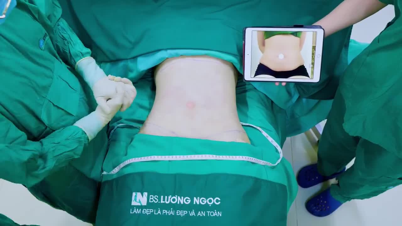 Sáng nay ekip chào đón chị T đến tư vấn dịch vụ hút mỡ.
