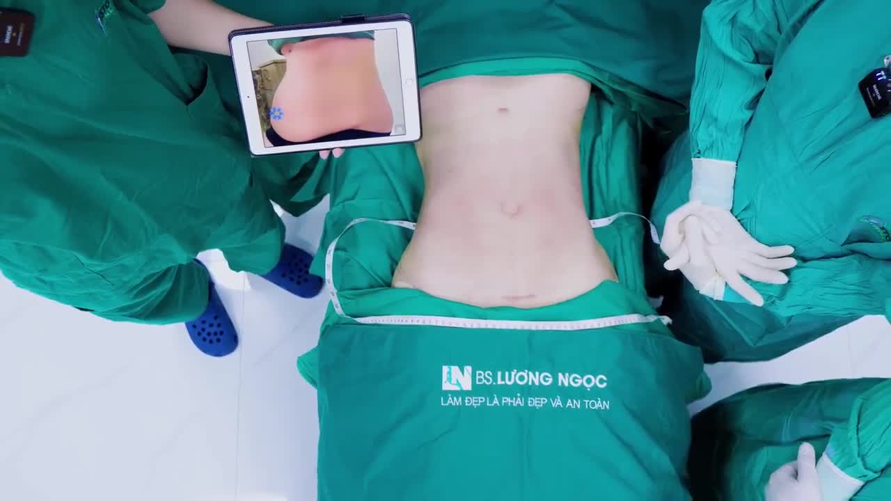 Sau lần sinh mổ đầy đau đớn, chị khách phải chịu vết sẹo lồi dài ngoằng trên bụng và để lại nỗi ám ảnh về việc phẫu thuật.