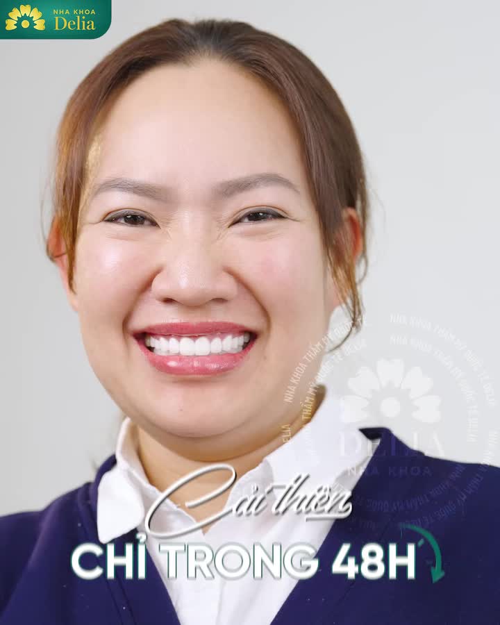 "Điều mình cảm thấy vui nhất trong năm 2024 là làm được bộ răng sứ vừa đẹp vừa tự nhiên để chơi Tết!!"