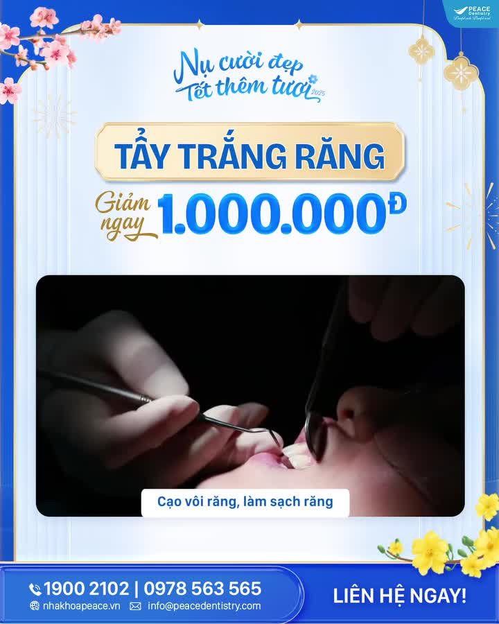 TỎA SÁNG NỤ CƯỜI ĐÓN TẾT, GIẢM NGAY 1.000.000Đ