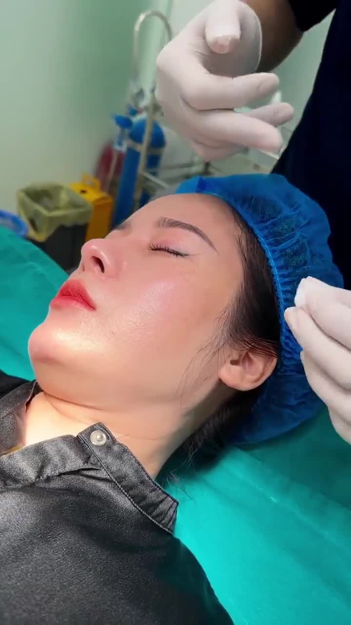 TIÊM XÓA NHĂN ĐUÔI MẮT - NHẸ NHÀNG - AN TOÀN - HIỆU QUẢ