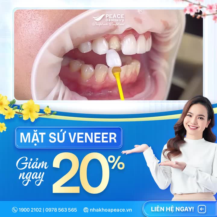 NỤ CƯỜI ĐẸP, TẾT THÊM TƯƠI CÙNG ƯU ĐÃI 20% VENEER TẠI PEACE DENTISTRY