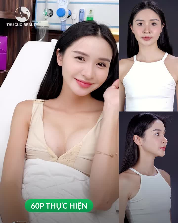 Giải pháp sở hữu V1 sexy khe Yline  chỉ sau 60P thực hiện