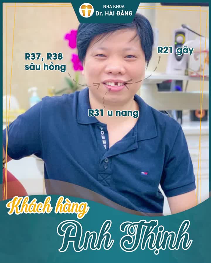 ĐIỀU TRỊ RĂNG SÂU HỎNG VÀ PHỤC HÌNH RĂNG BỊ MẤT