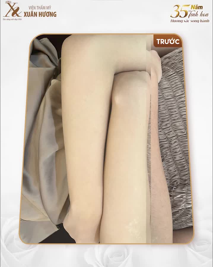 TRIỆT LÔNG C- PLUS - HOÀN THIỆN LÀN DA CỦA BẠN TỪ NHỮNG ĐIỀU NHỎ NHẤT.