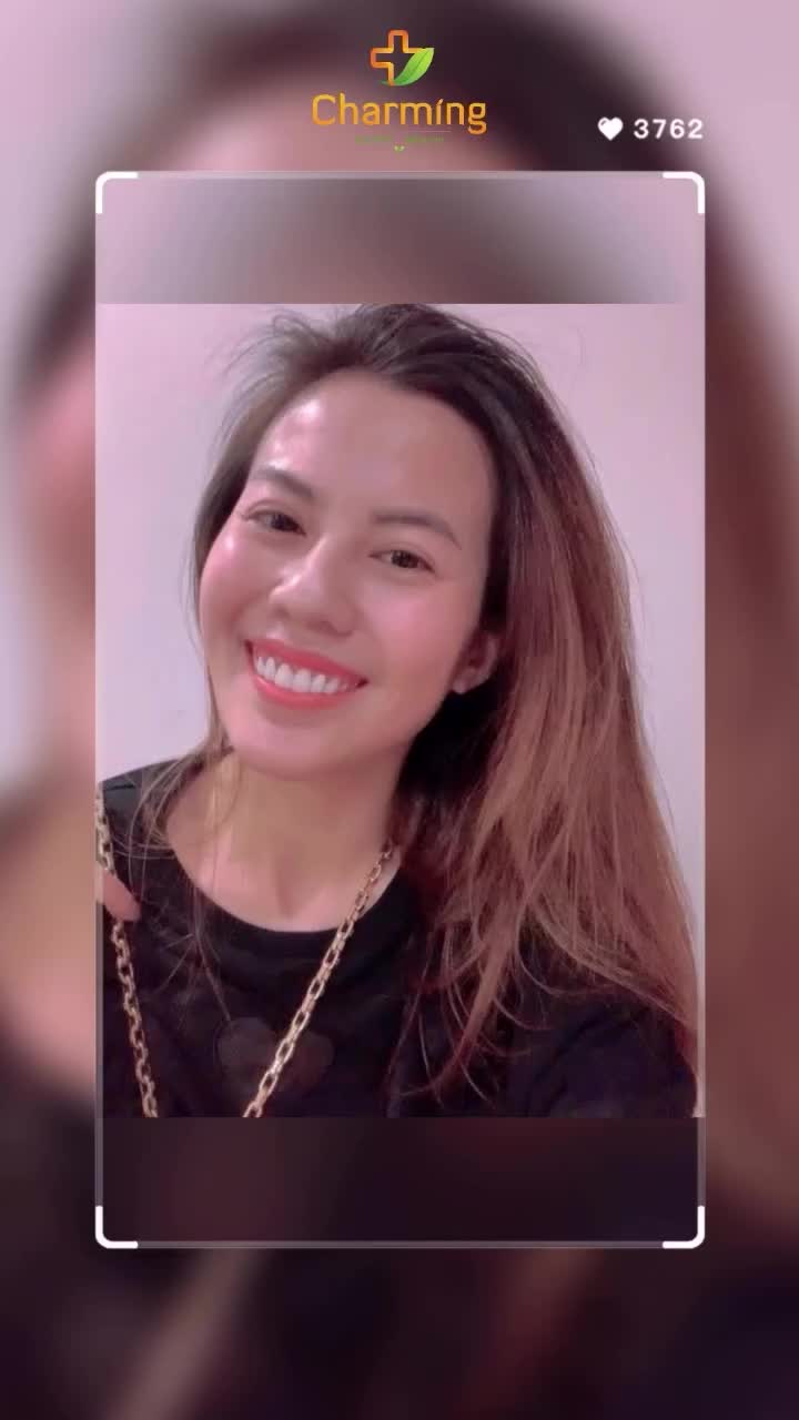 Nàng khách độn cằm nhà TMV Charming khiến ai cũng phải xuýt xoa bởi vẻ ngoài rạng rỡ, tự nhiên nhưng không kém phần cuốn hút.