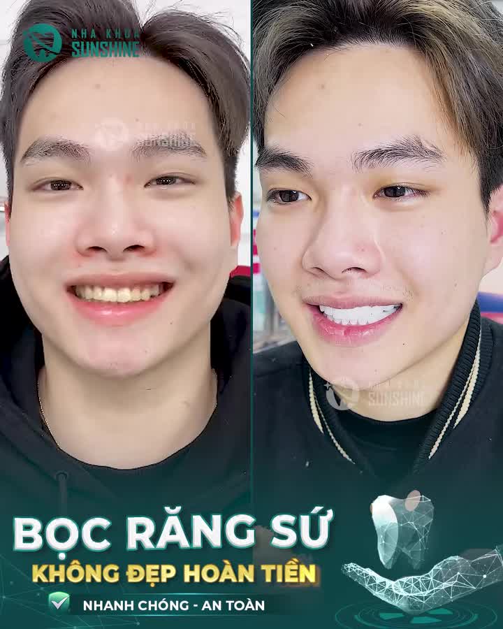 "Nếu cho em chấm điểm, thì em sẽ chấm 10 điểm không có nhưng"