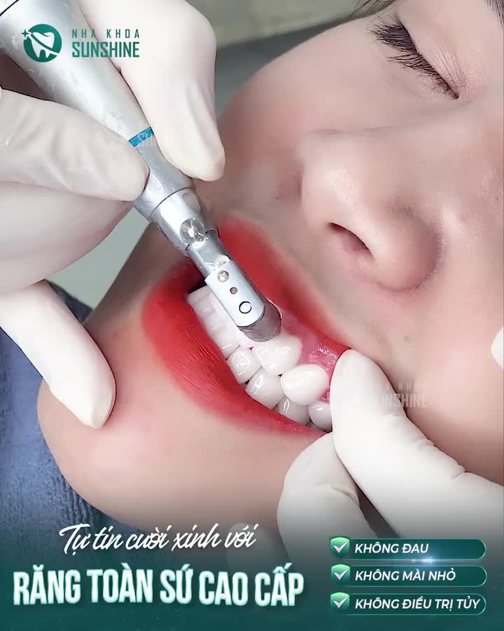TỰ TIN CƯỜI XINH VỚI RĂNG TOÀN SỨ CAO CẤP