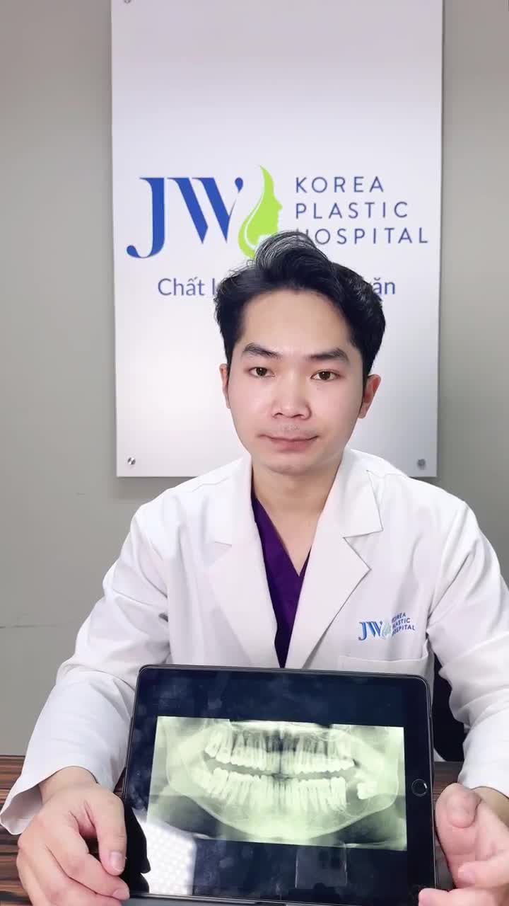 Bác sĩ Khoa Răng Hàm Mặt JW tiết lộ những nguy cơ tìm ẩn khi RĂNG KHÔN mọc nghiêng