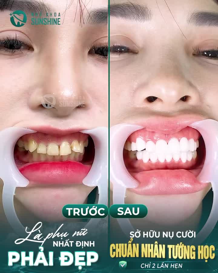 PHỤ NỮ ĐẸP NHẤT KHI BIẾT YÊU CHÍNH MÌNH