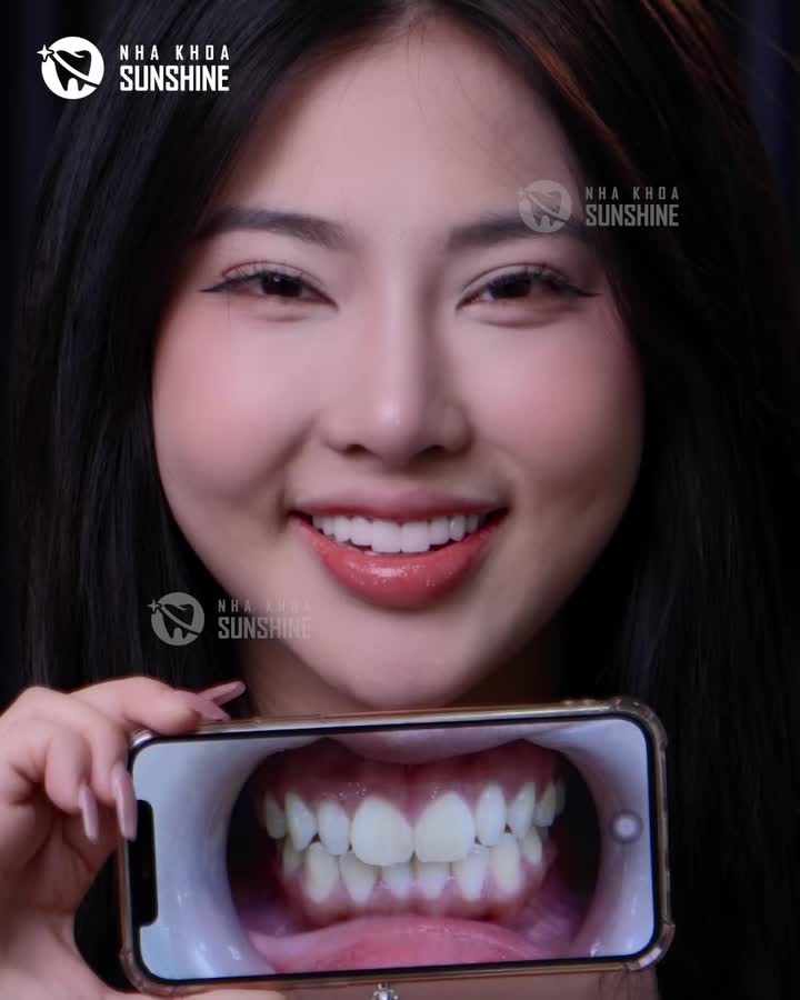 HOT TIKTOKER QUỲNH NHƯ HÉ LỘ SỰ THẬT VỀ LÀM RĂNG SỨ: